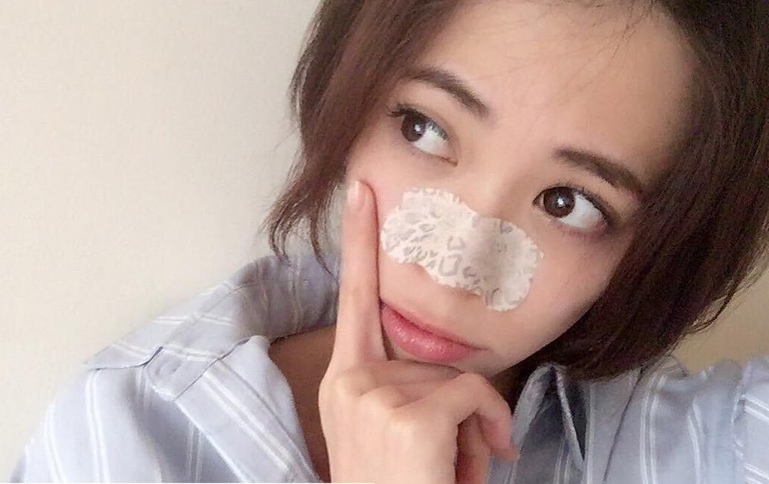 neu mat van noi day mun khi dung kem tri mun, han ban da bo qua nhung dieu nay! - 1