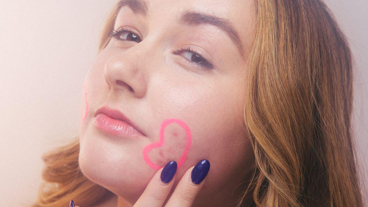 neu mat van noi day mun khi dung kem tri mun, han ban da bo qua nhung dieu nay! - 2