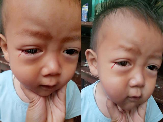 thay con trai khoc ra mau, me hoang hot phat hien nguyen nhan tu thu quen thuoc - 1