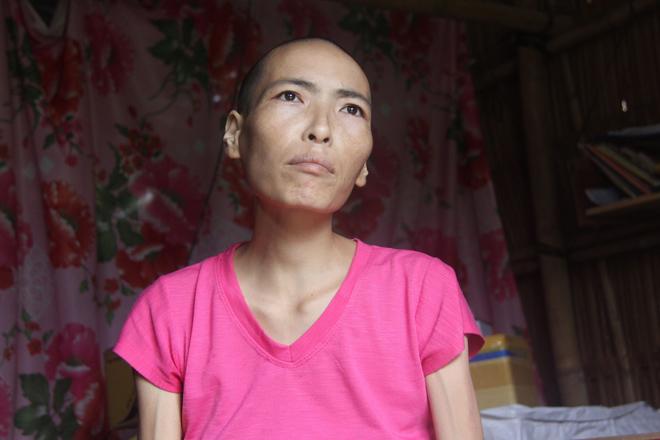 mac gia dinh phan doi, chang trai van nguyen cham soc nguoi dan ba mot doi chong bi ung thu - 2