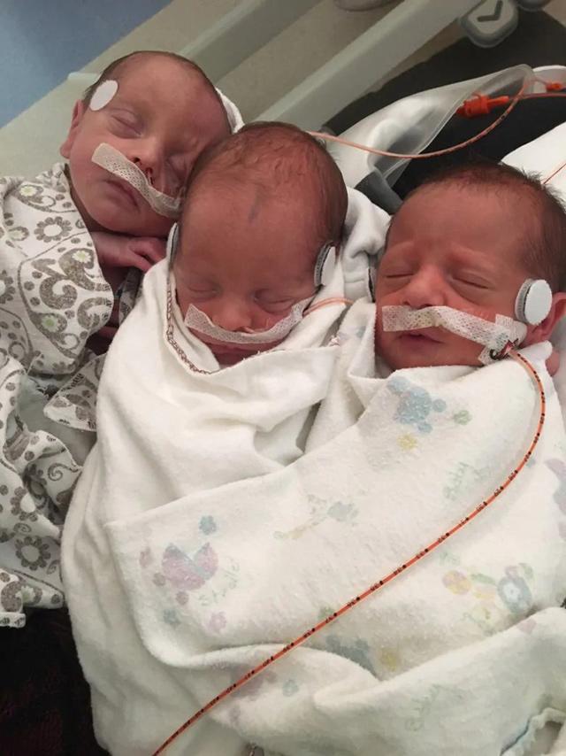 ky tich sinh 3: me vua so cuu cho con bi ngat tho, vua sinh them 2 be khac - 3