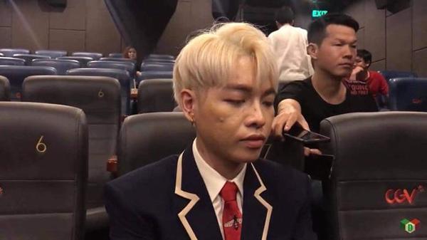 bat ngo truoc hinh anh cua duc phuc sau 1 nam phau thuat tham my - 6