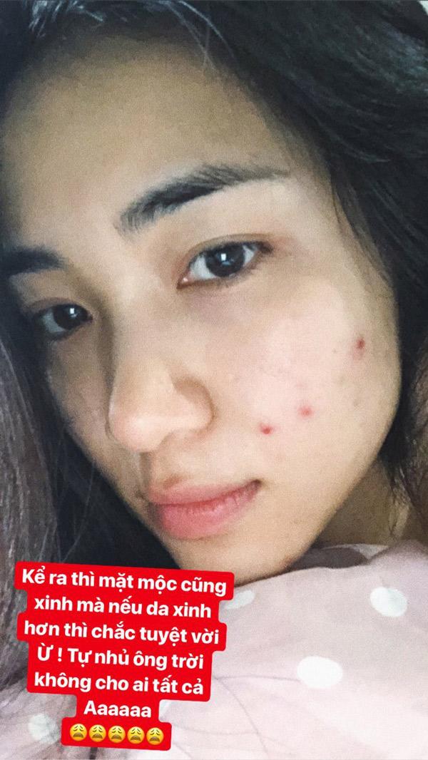 dang anh khoe dang, fan lo lang nhan xet hoa minzy dang "gay den tham thuong"! - 9