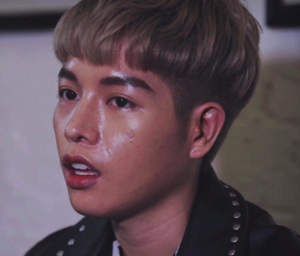 bat ngo truoc hinh anh cua duc phuc sau 1 nam phau thuat tham my - 7