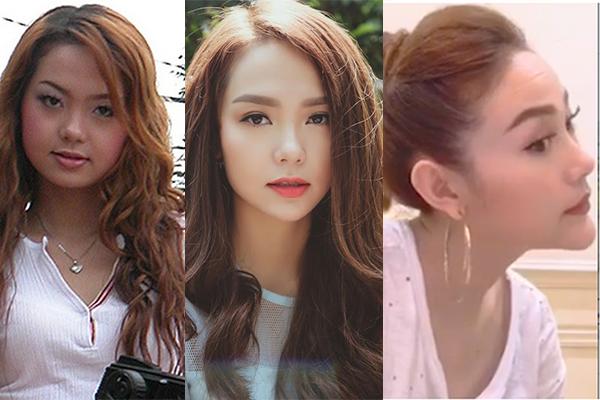 bat ngo truoc hinh anh cua duc phuc sau 1 nam phau thuat tham my - 11