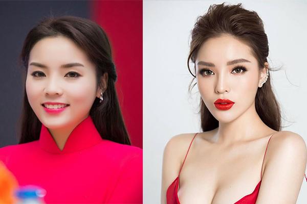 bat ngo truoc hinh anh cua duc phuc sau 1 nam phau thuat tham my - 15