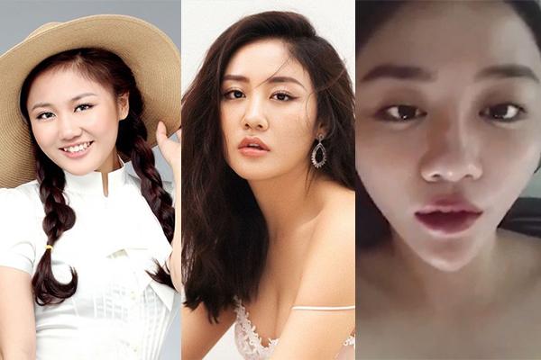 bat ngo truoc hinh anh cua duc phuc sau 1 nam phau thuat tham my - 12