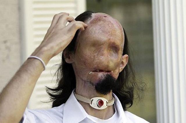 bi vo bo vi qua xau 8 nam truoc, nguoi dan ong "khong mat" bay gio ra sao? - 1