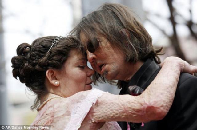 bi vo bo vi qua xau 8 nam truoc, nguoi dan ong "khong mat" bay gio ra sao? - 6