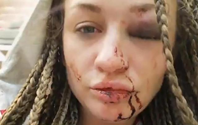 chong 88 tuoi ngoai tinh, co vo 28 tuoi danh ghen nhan tinh tre sung tim mat may - 4