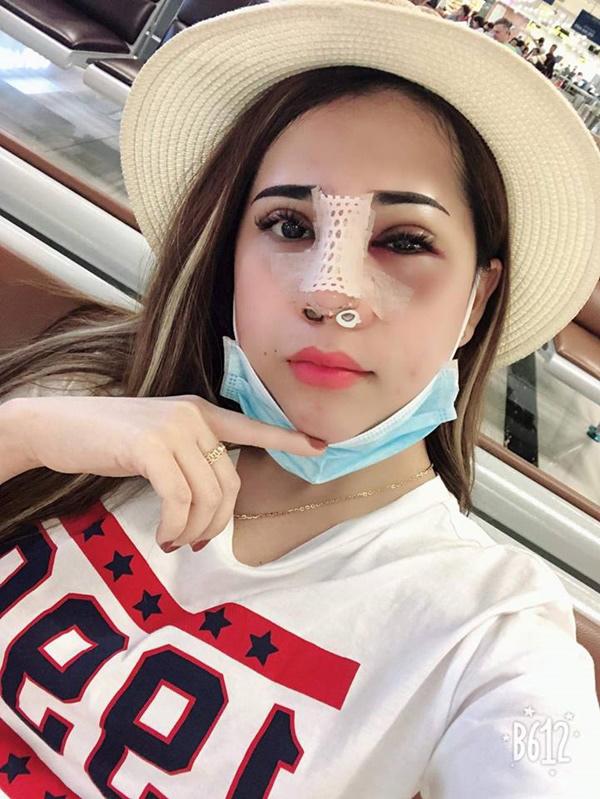 lai them mot vu sua mat nat bet roi len mang than, co troi moi cuu duoc - 2