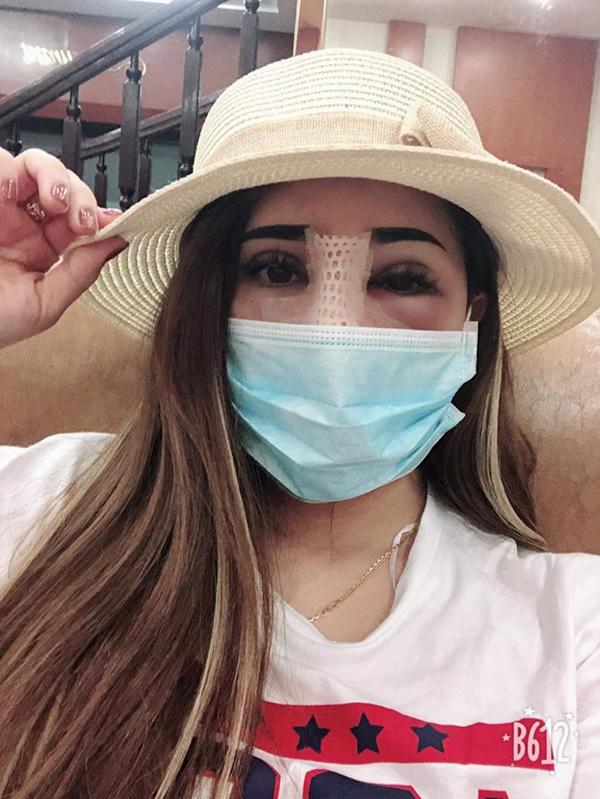 lai them mot vu sua mat nat bet roi len mang than, co troi moi cuu duoc - 3