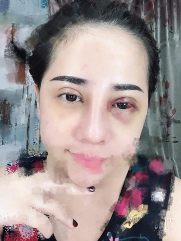 lai them mot vu sua mat nat bet roi len mang than, co troi moi cuu duoc - 4