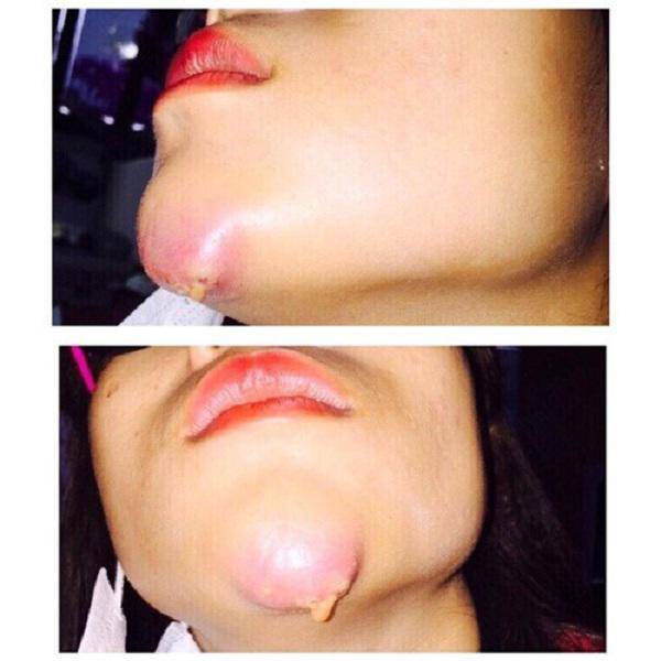 lai them mot vu sua mat nat bet roi len mang than, co troi moi cuu duoc - 7