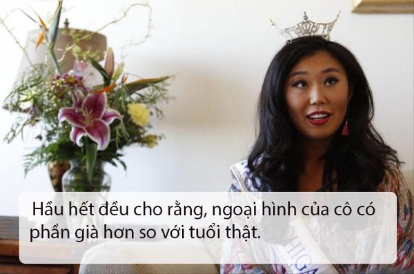 that bat ngo, le au ngan anh lot top hoa hau... xau nhat the gioi - 14