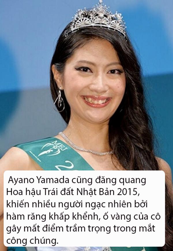 that bat ngo, le au ngan anh lot top hoa hau... xau nhat the gioi - 9