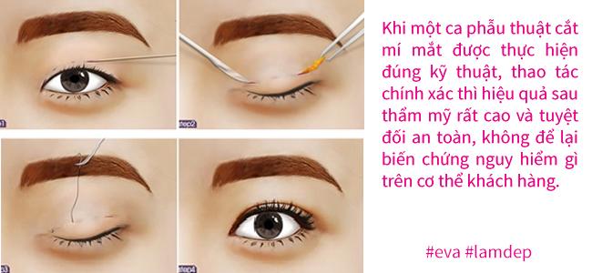 giai dap 5 cau hoi thuong gap khien chi em ban khoan truoc khi tham my mat - 3