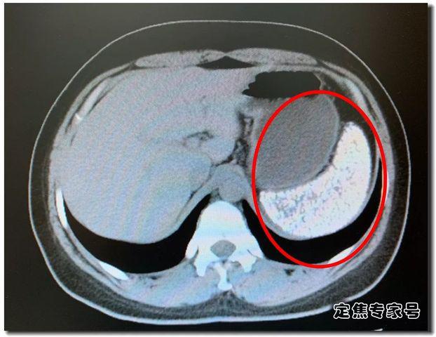 la lach cua co gai 28 tuoi nhu vien gach ro, bac si hai hung khi biet ly do - 2