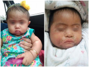 Con gái 5 tháng tuổi bị nhiễm trùng da nghiêm trọng, người mẹ bất ngờ khi biết nguyên nhân