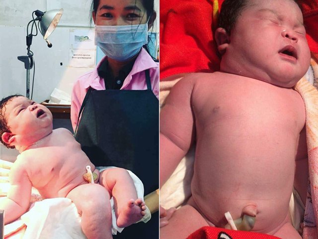 Sản phụ đẻ thường em bé khổng lồ 6,8kg, danh tính đứa trẻ khiến mẹ Việt ngạc nhiên