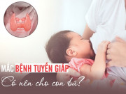 Nỗi lo của nhiều mẹ Việt: Mắc bệnh tuyến giáp có được sinh con và cho con bú?