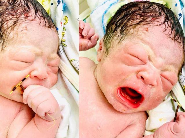 Sự thật về em bé Hải Phòng chào đời cầm vòng tránh thai trong tay gây bão MXH