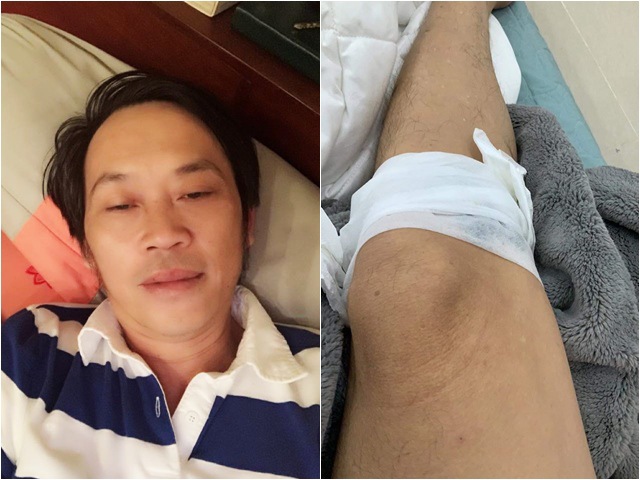 Sao Việt 24h: Hoài Linh bị thương phải băng chân, fan vừa thương vừa buồn cười
