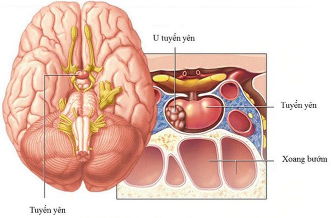 Căn bệnh khiến nam ca sĩ Wanbi Tuấn Anh qua đời cách đây 7 năm nguy hiểm thế nào? - 3