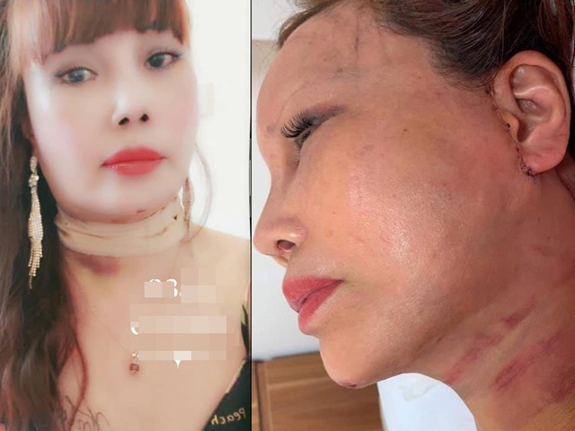 Tuyên bố mang bầu, nhập viện trong đêm... cô dâu Thu Sao khiến dân mạng không ít lần amp;#34;hú hồnamp;#34; - 7