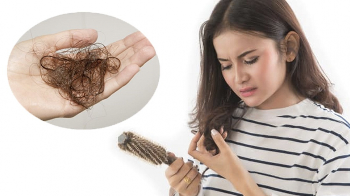 Cách Trị Rụng Tóc Cực Hiệu Quả Nên Thử VITA Clinic #33 Cách Trị Rụng Tóc Cực Hiệu Quả Nên Thử VITA Clinic