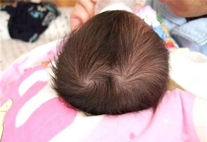 Nhìn xoáy tóc biết vận mệnh, trẻ có 2 xoáy đầu thường nghịch ngợm, tài giỏi hơn người - 1
