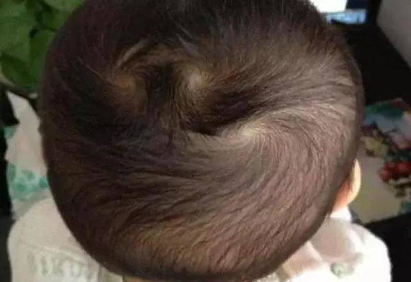 Nhìn xoáy tóc biết vận mệnh, trẻ có 2 xoáy đầu thường nghịch ngợm, tài giỏi hơn người - 3