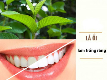 22 Cách làm trắng răng tự nhiên tại nhà hiệu quả nhanh nhất