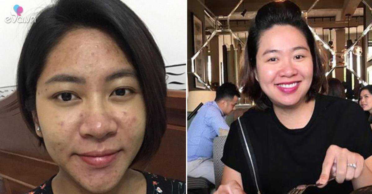 Mỹ nhân Việt phá dáng, xuống sắc khi mang thai, Hoa hậu cũng mụn lên chi chít - Vimarsana News