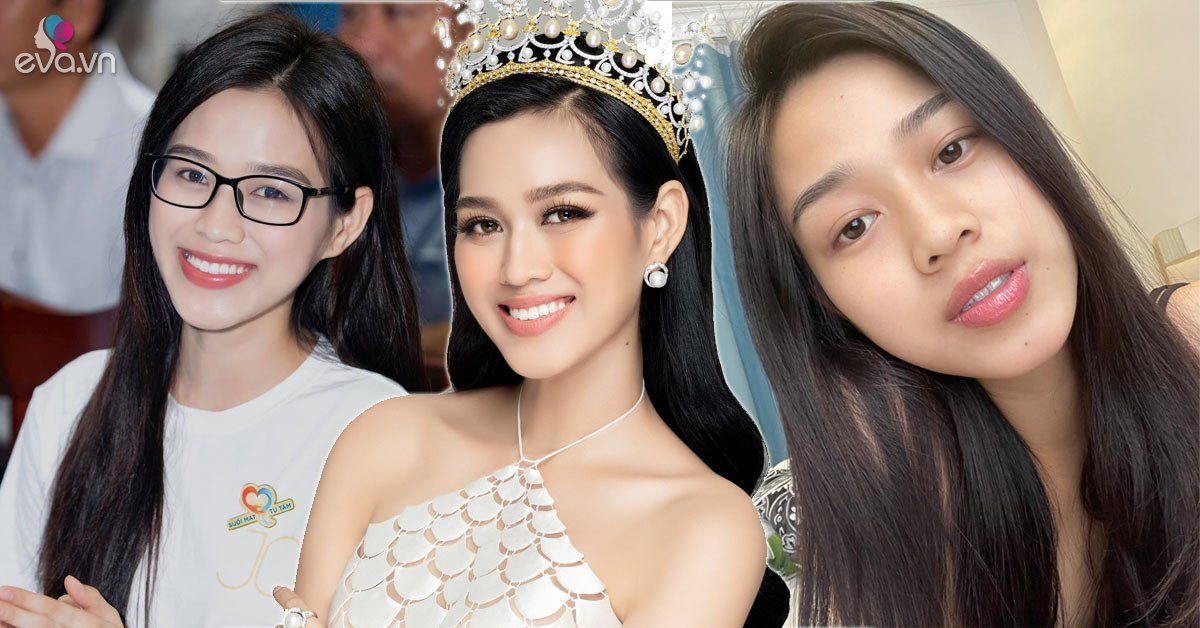 Đỗ Thị Hà công khai tu sửa hàm răng nhưng lại chối đây đẩy 1 bộ phận khác - Vimarsana News
