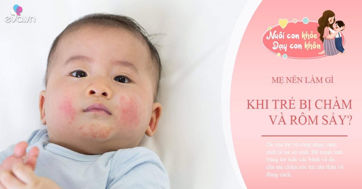 Mùa hè nắng nóng, cách chăm trẻ sơ sinh để da con mát mịn không rôm sảy, đen sạm - Vimarsana News
