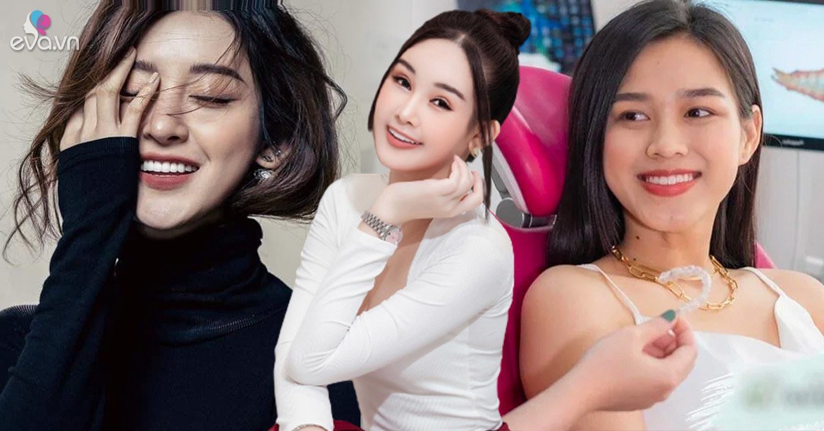 Thẩm mỹ nụ cười được nhiều Hoa hậu ứng dụng như thế nào - Vimarsana News