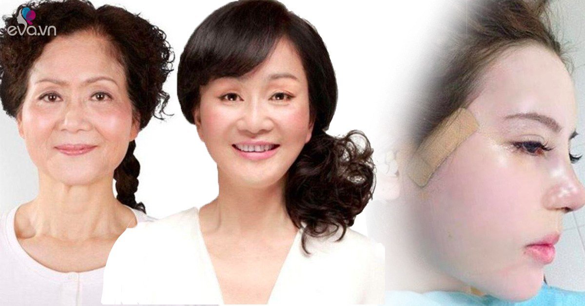 Bất ngờ chuyện cải lão hoàn đồng ra cả chục tuổi chỉ nhờ vài chục phút độn thái dương - Vimarsana News
