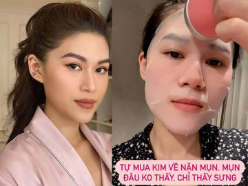 Ái nữ đại gia Ngọc Thanh Tâm tự mua kim nặn mụn, làn da nhận cái kết đắng