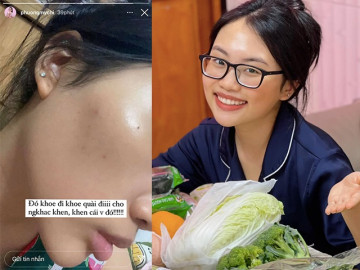 Phương Mỹ Chi mếu máo vì chăm da: Skincare cật lực nhưng skin không care