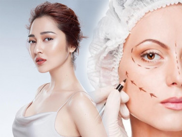 Những bộ phận dễ bị nhìn nhầm là phẫu thuật thẩm mỹ nhất trên gương mặt sao Việt - Vimarsana News