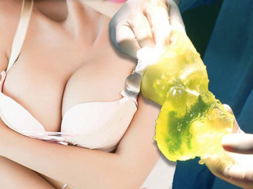 Thắc mắc lớn: Nâng ngực 1 thời gian có bị nhỏ đi không và bao lâu phải sửa sang lại? - Vimarsana News