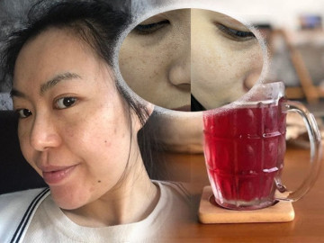 Rẻ-Đẹp-Dễ: Đau khổ vì nám, chị em 30 cứ chấm loại nước này, giá chỉ 3k mà da sáng khoẻ - Vimarsana News