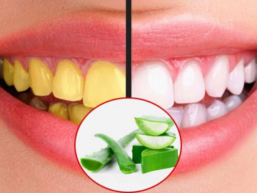 10 công thức giúp răng ố vàng trở nên trắng sáng