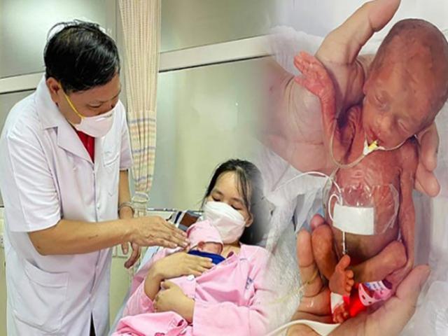 Em bé Nghệ An chào đời 400g, chỉ nhỏ bằng chiếc xi lanh được cứu sống thần kỳ thế nào