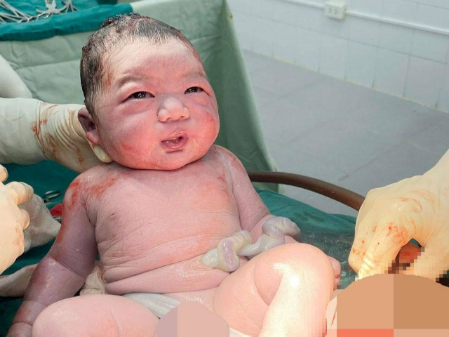 Bắc Giang: Cấp cứu mổ lấy thai cho sản phụ 94 kg, bé trai chào đời nặng 5 kg