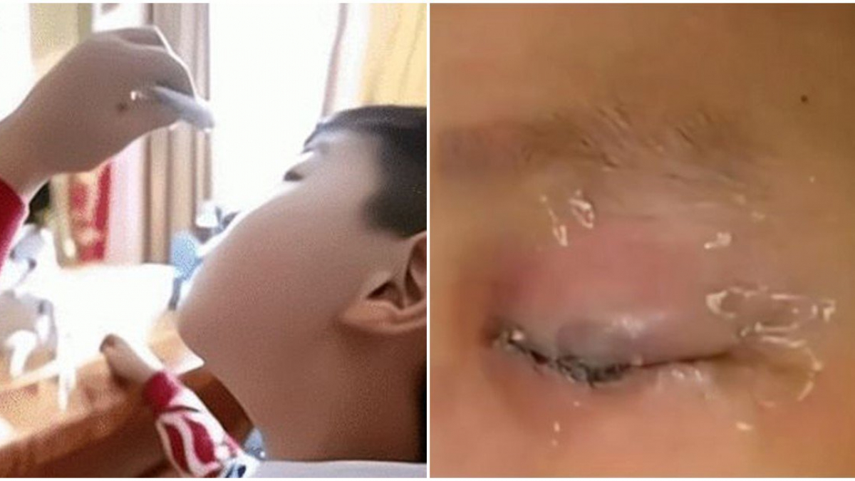 Con Nhỏ Keo 502 Vào Mắt, Mẹ Đắp Thêm Khăn Tẩm Nước Được Bác Sĩ Khen: Quá Thông Minh!
