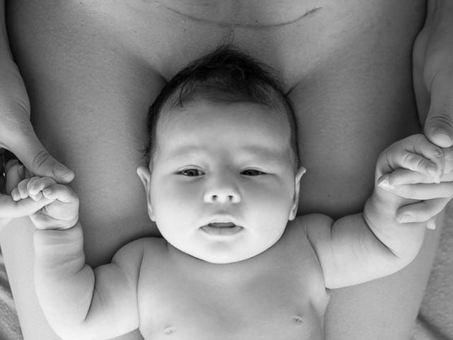Những điều quan trọng tiết lộ bạn có thể sinh thường sau sinh mổ được không?