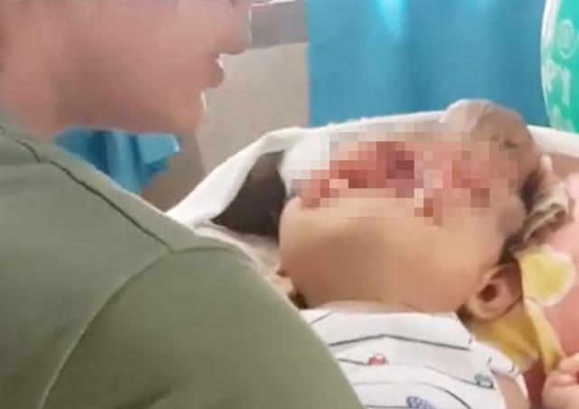 me bau tu uong thuoc khi sot va luoi sieu am, soc nang khi nhin mat con luc chao doi - 1