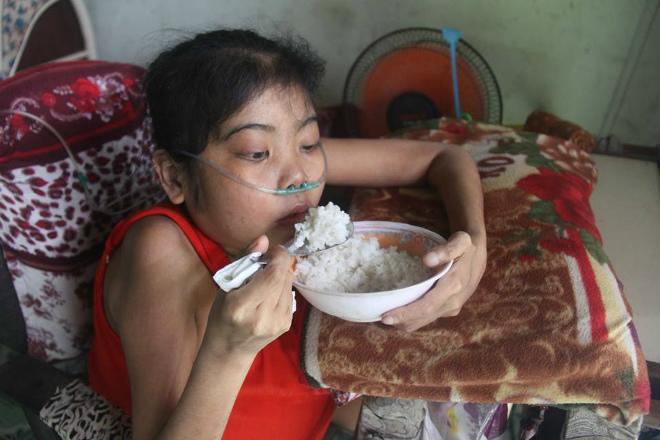 co gai vac chiec bung to tuong suot 12 nam, bi am anh “neu khong truyen mau, no se chet” - 4